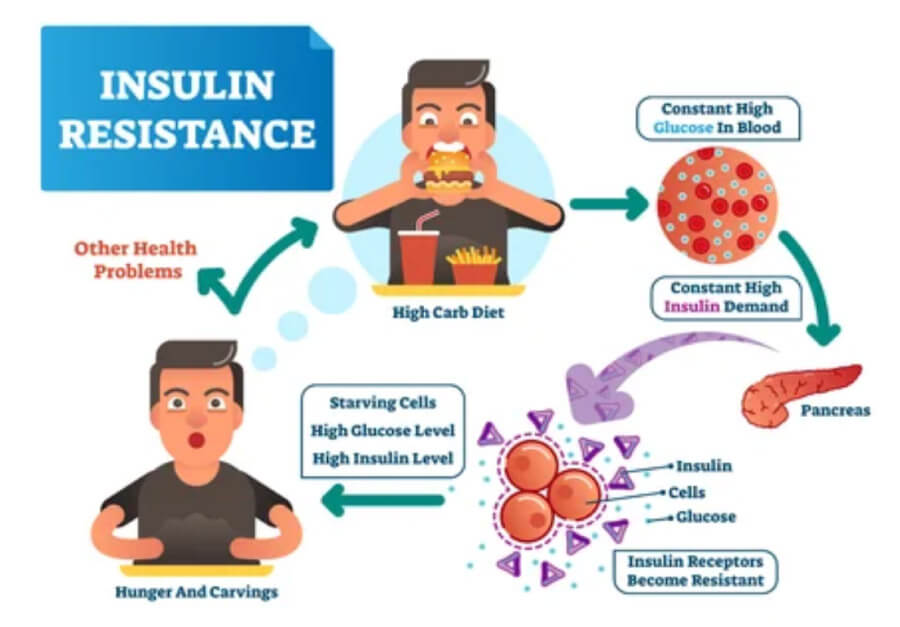 What Is Type 2 Diabetes How To Reverse Type 2 Diabetes Explained